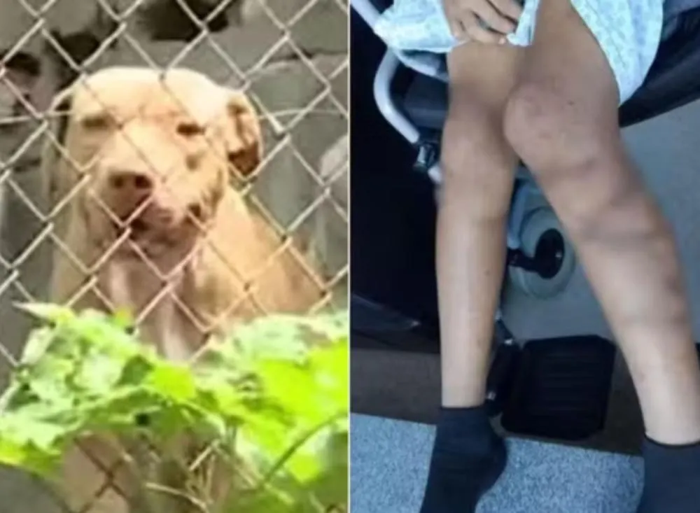 Ataque de pit bulls deixa cadela morta e menino de 12 anos gravemente ferido no interior de SP / Foto: Arquivo Pessoal